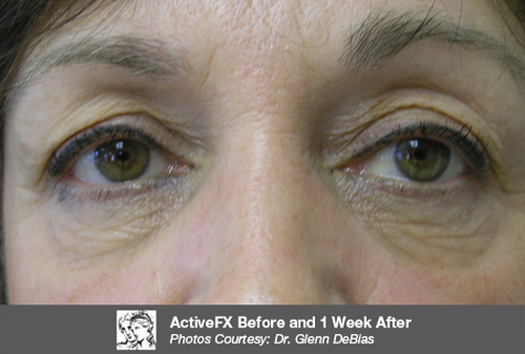 After ActiveFX